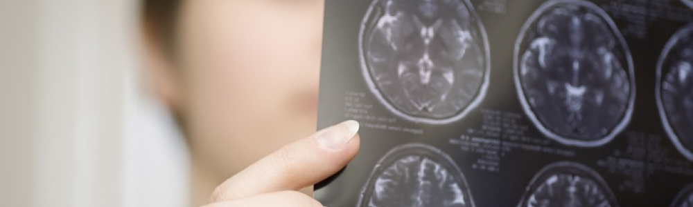 Энергично трясти головой опасно для мозга