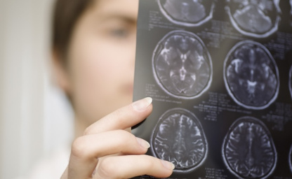 Энергично трясти головой опасно для мозга